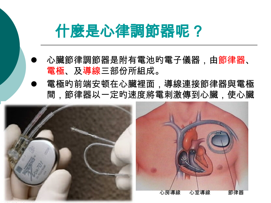 心脏内科心律调节器卫教.ppt_第2页