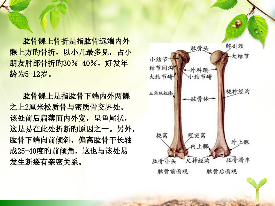 肱骨髁上骨折汇总.ppt_第2页