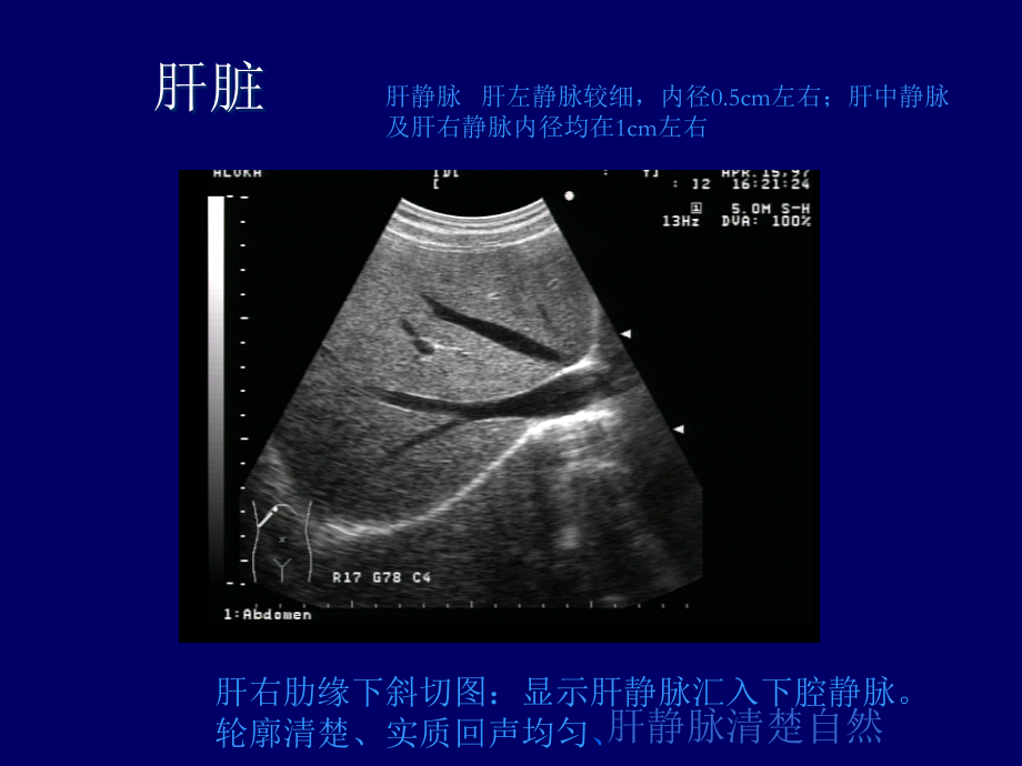 B超影像图谱专题知识.ppt_第2页