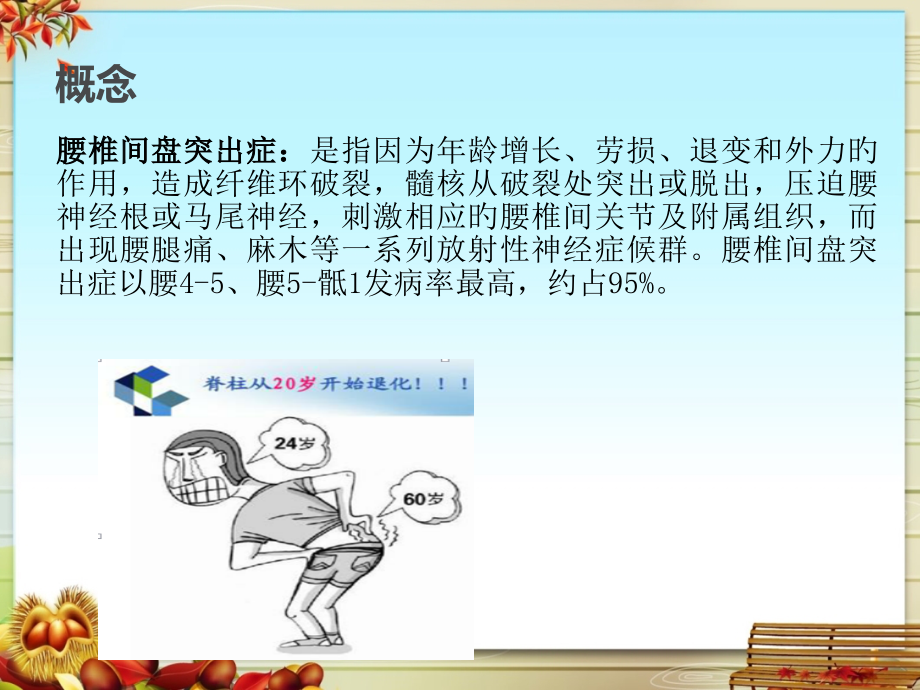 腰椎间盘突出症专业版.pptx_第2页