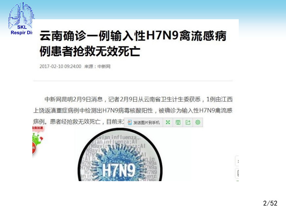新版人感染HN禽流感诊疗方案年.pptx_第2页