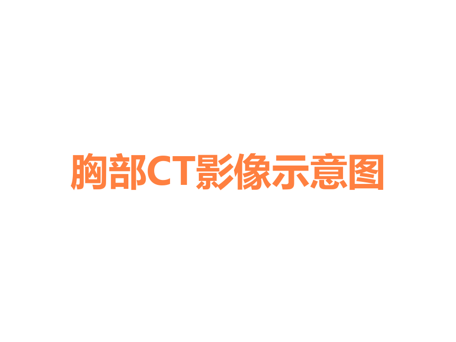 胸部CT影像示意图.ppt_第1页