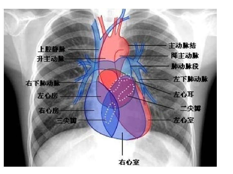 胸部CT影像示意图.ppt_第2页