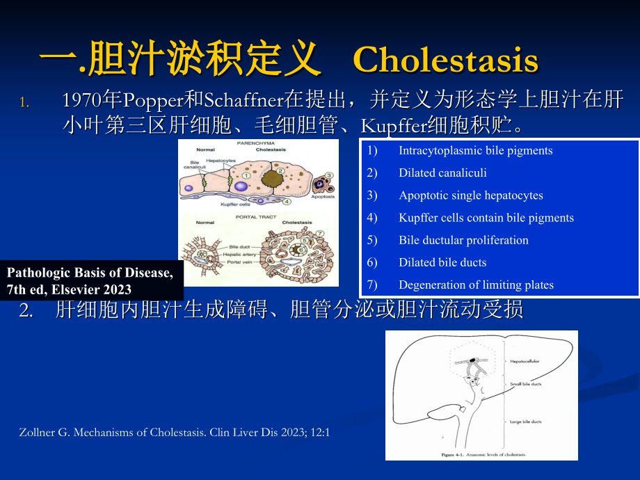 胆汁淤积症的诊疗治疗.pptx_第2页