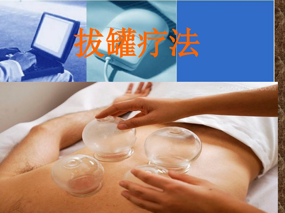 拔罐疗法.pptx_第1页