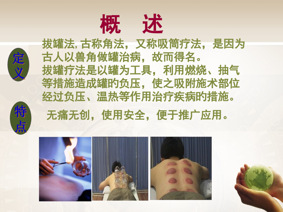 拔罐疗法.pptx_第2页
