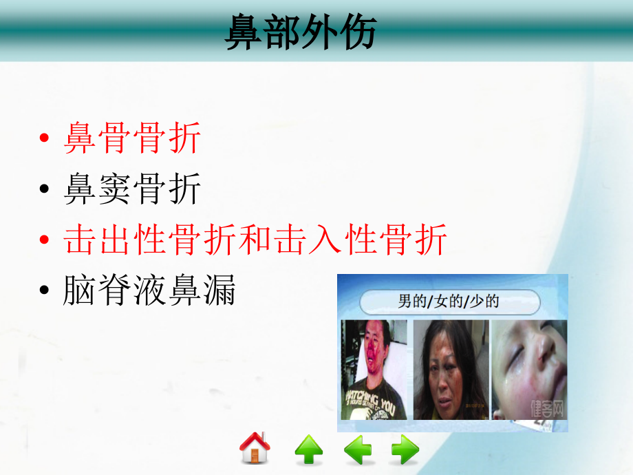 鼻外伤医学专业知识宣.ppt_第2页