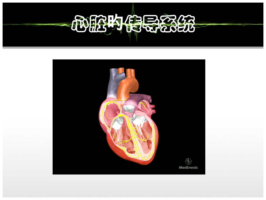 起搏器的高级功能.ppt_第2页