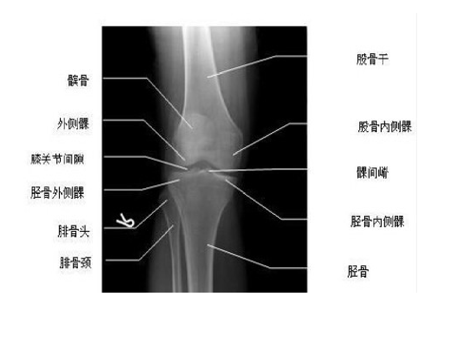 正常膝关节超声检查讲解.pptx_第2页