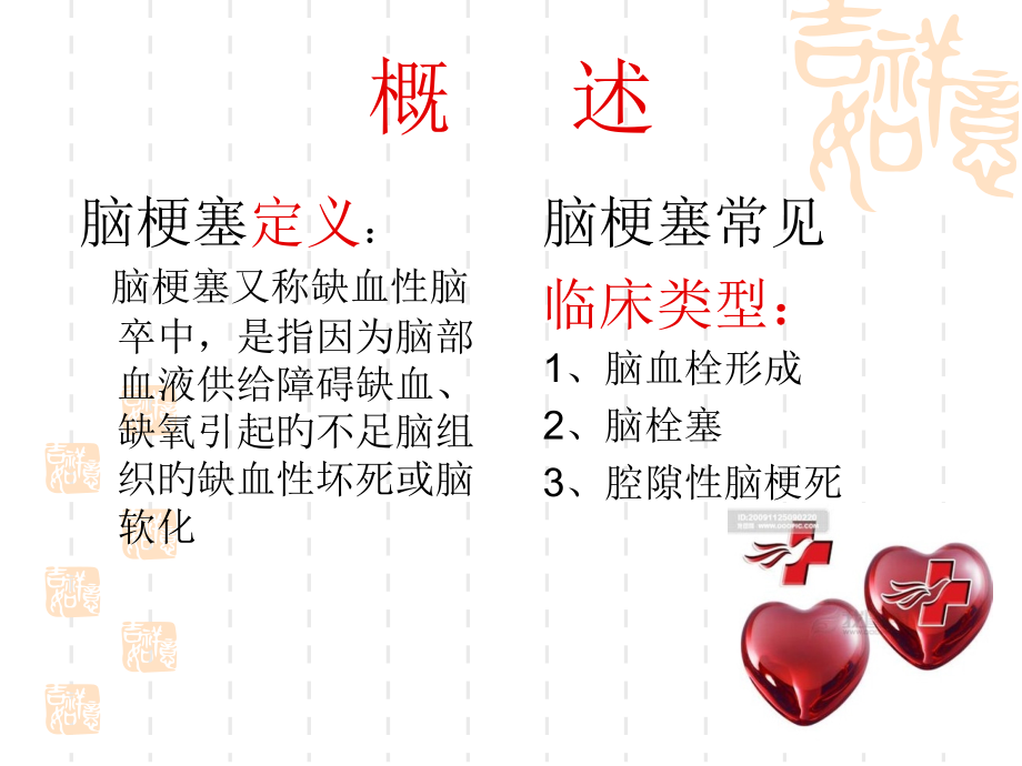 脑梗塞医疗护理常规.ppt_第2页