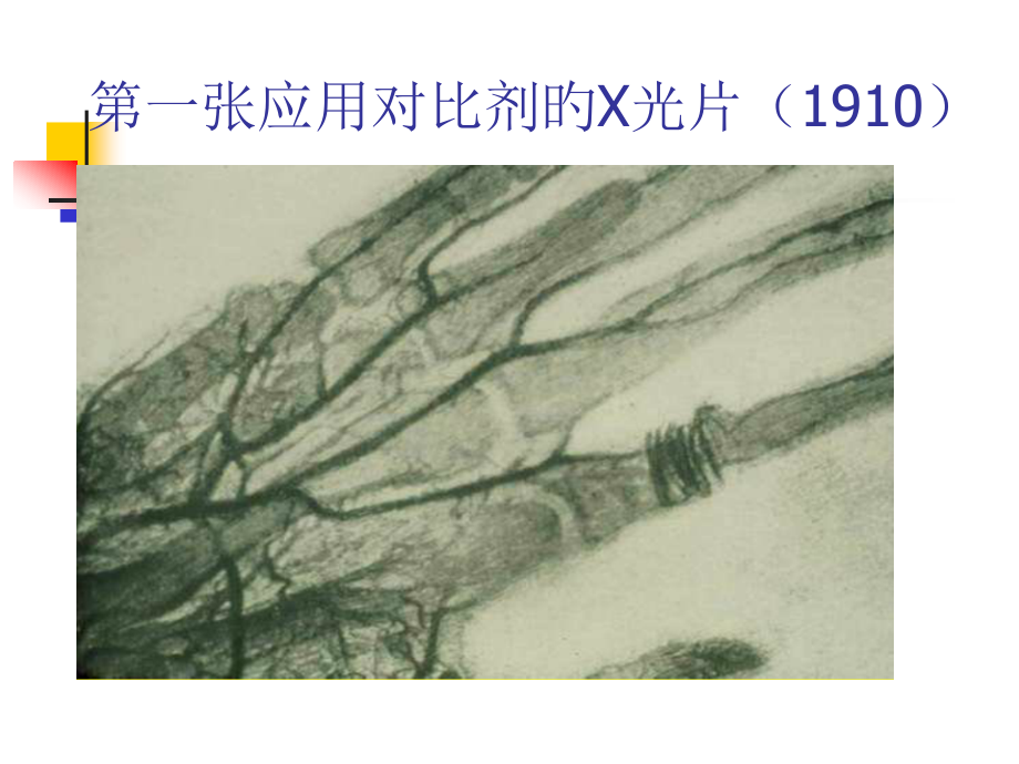 对比剂肾病专题知识宣讲.pptx_第2页
