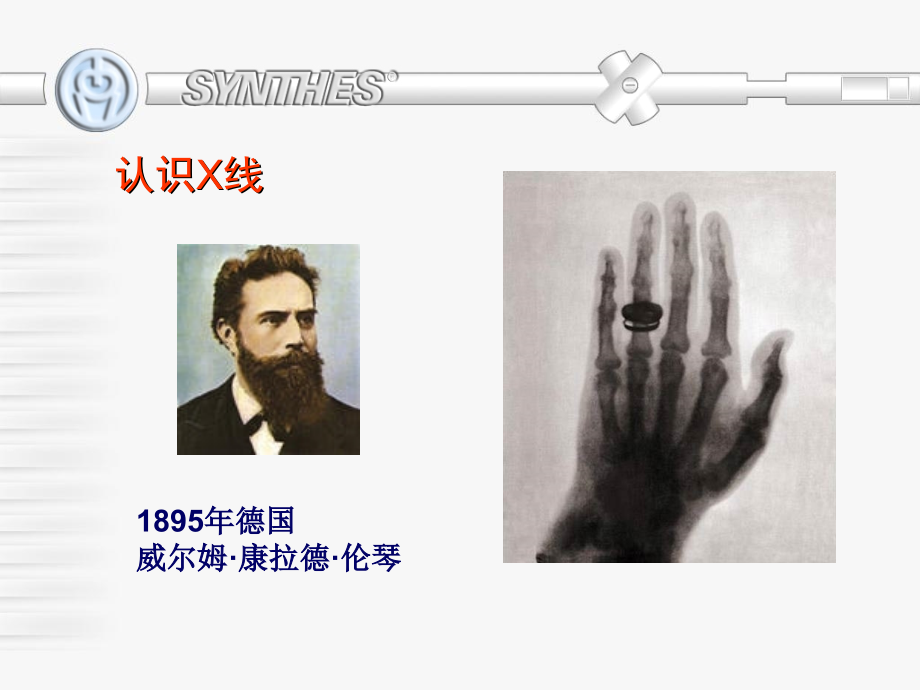 骨科X线基本知识讲义.ppt_第2页