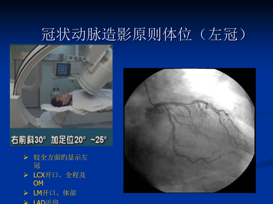 冠脉造影投照体位.pptx_第2页