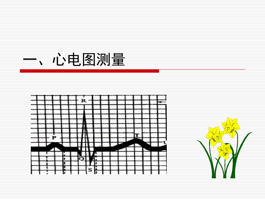 心电图测量和正常数据.ppt_第2页