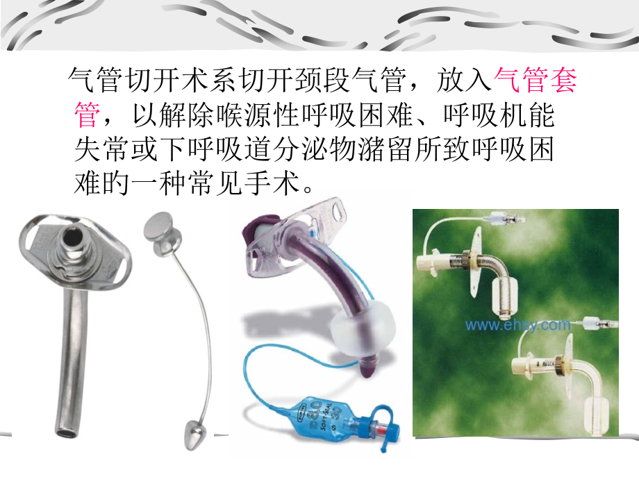 气管切开术讲解.ppt_第2页