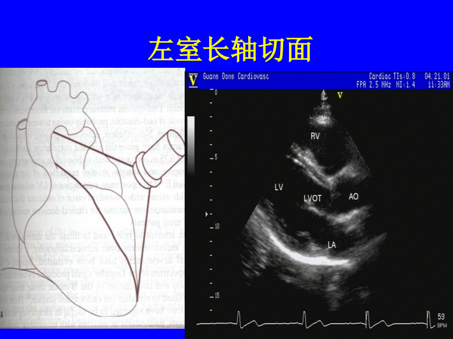 心脏超声标准切面及测量.pptx_第2页