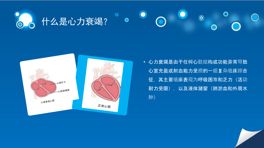 胡彬月业务学习心衰患者容量管理.ppt_第2页