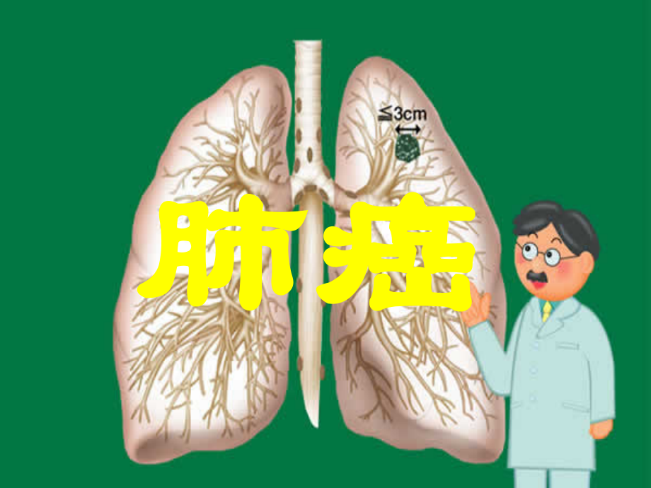 肺癌的诊疗和治疗.pptx_第1页