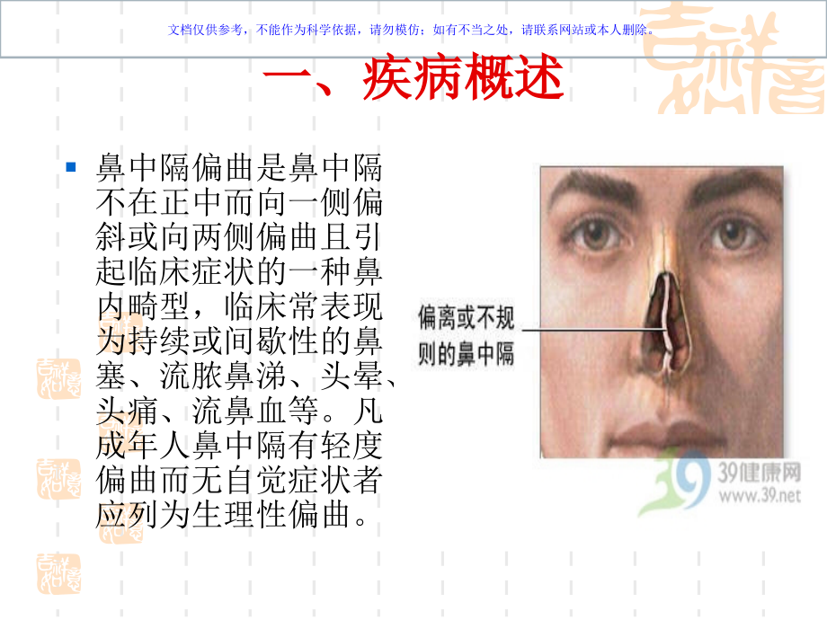 鼻中隔偏曲的健康教育课件.ppt_第1页