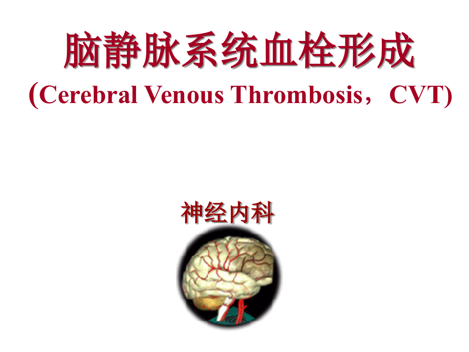 颅内静脉血栓形成讲解.pptx_第1页