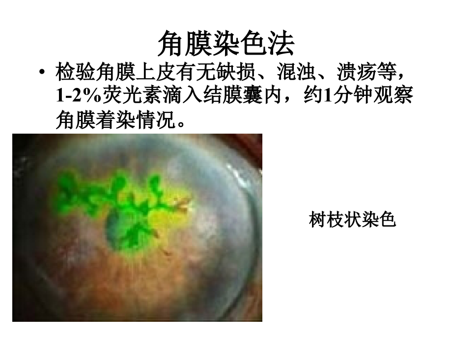 眼科检查法.pptx_第2页