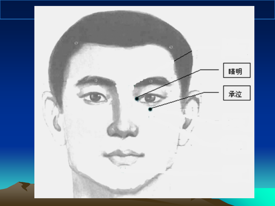 危险穴位解剖.ppt_第2页