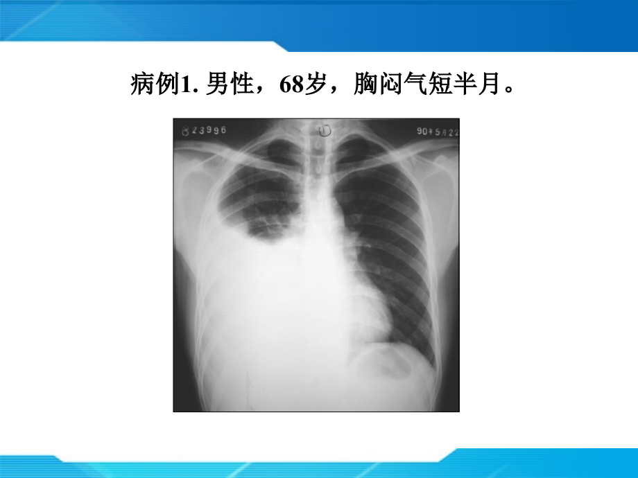 影像学读片专题讲座.ppt_第2页