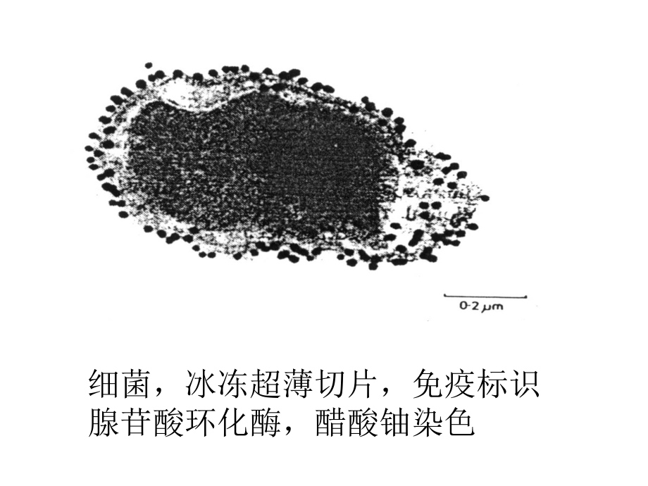 免疫电镜.ppt_第2页