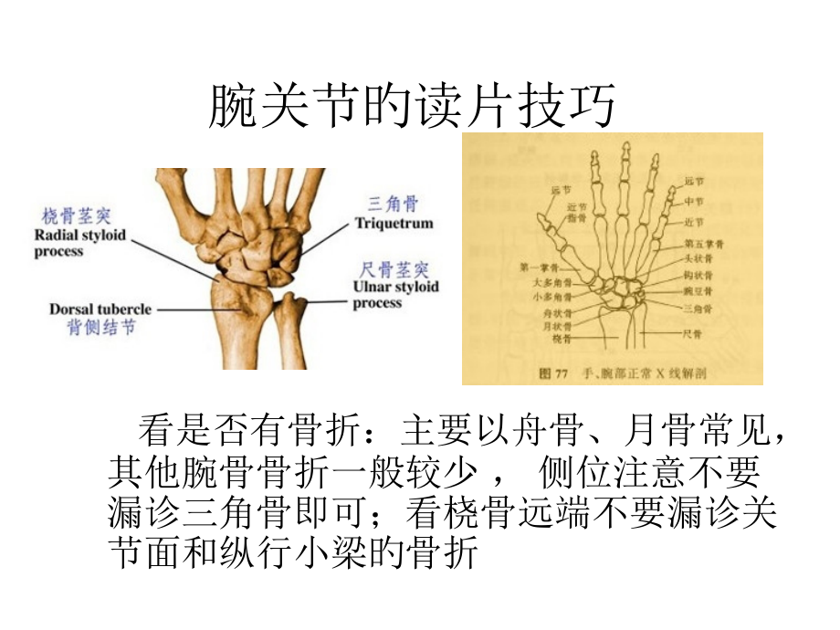 腕关节阅片技巧.pptx_第1页