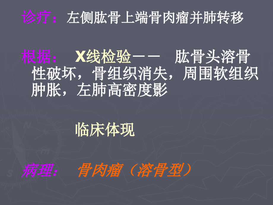 骨肉瘤X线诊疗.pptx_第2页