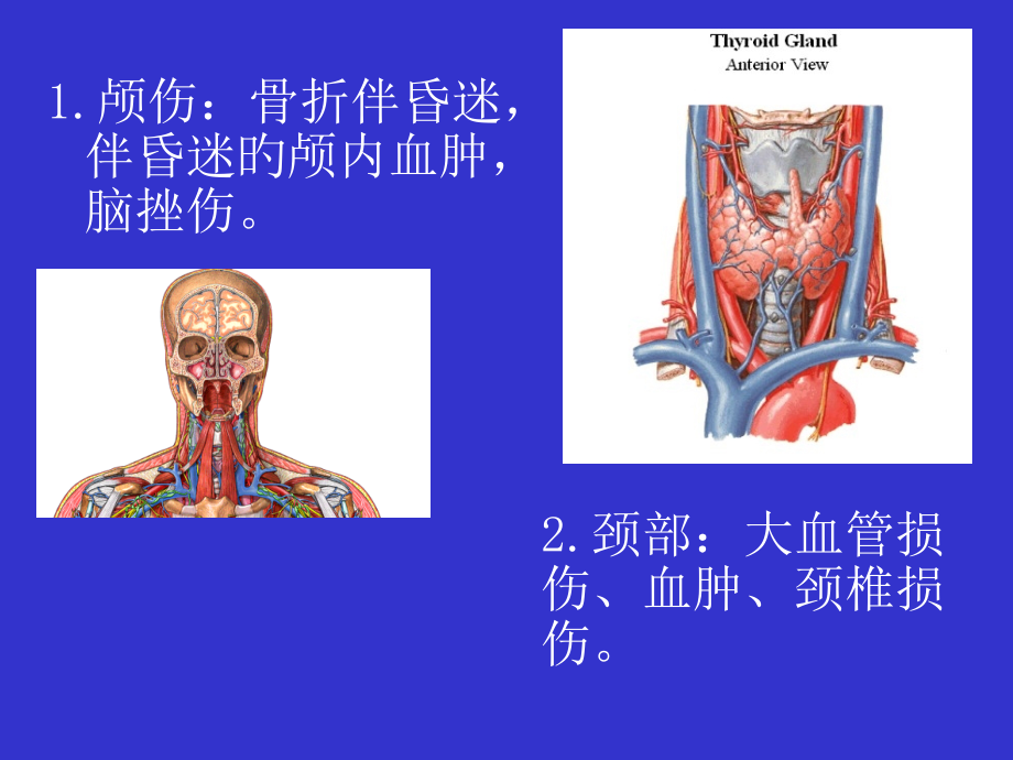多发伤急救专题知识.ppt_第2页