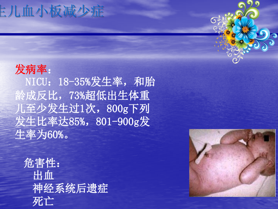 儿科新生儿血小板减少症.ppt_第2页