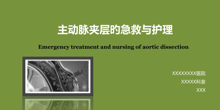 主动脉夹层的急救与护理宣讲.pptx_第1页