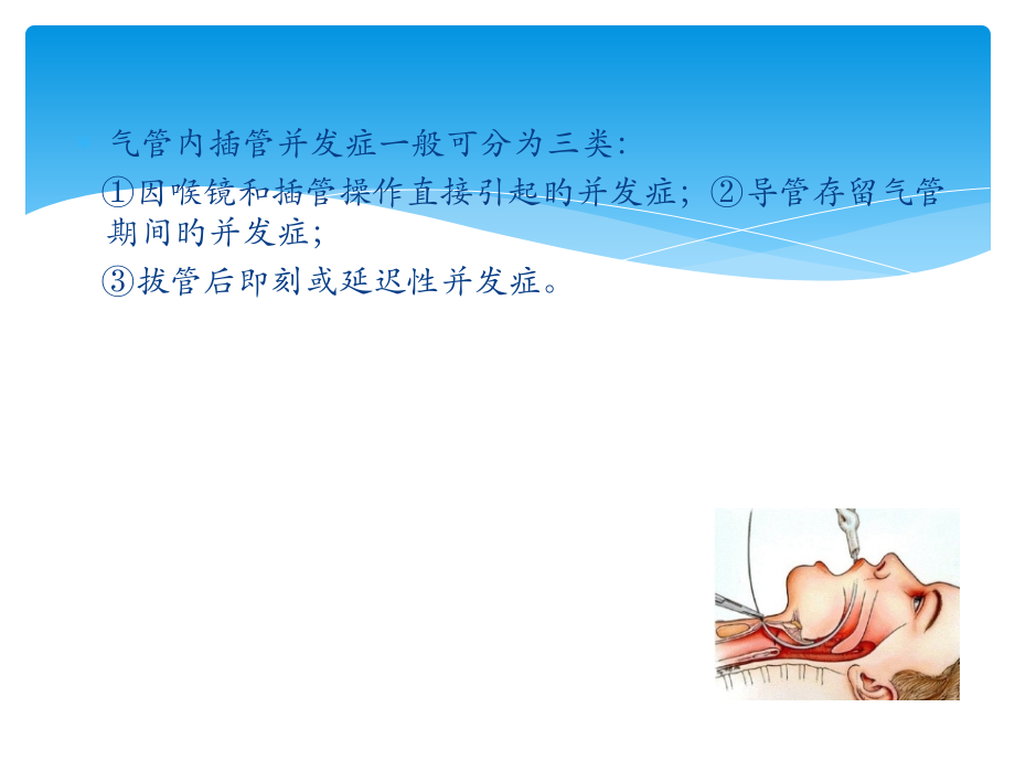 气管内插管并发症.pptx_第2页