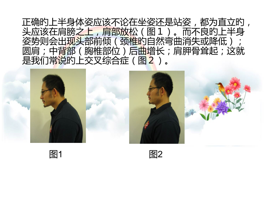 上交叉综合症.pptx_第2页