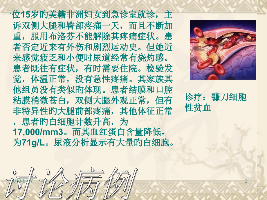 镰刀型细胞贫血症.pptx_第2页