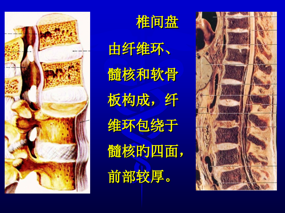 椎间盘病变影像诊断专家讲座.ppt_第2页