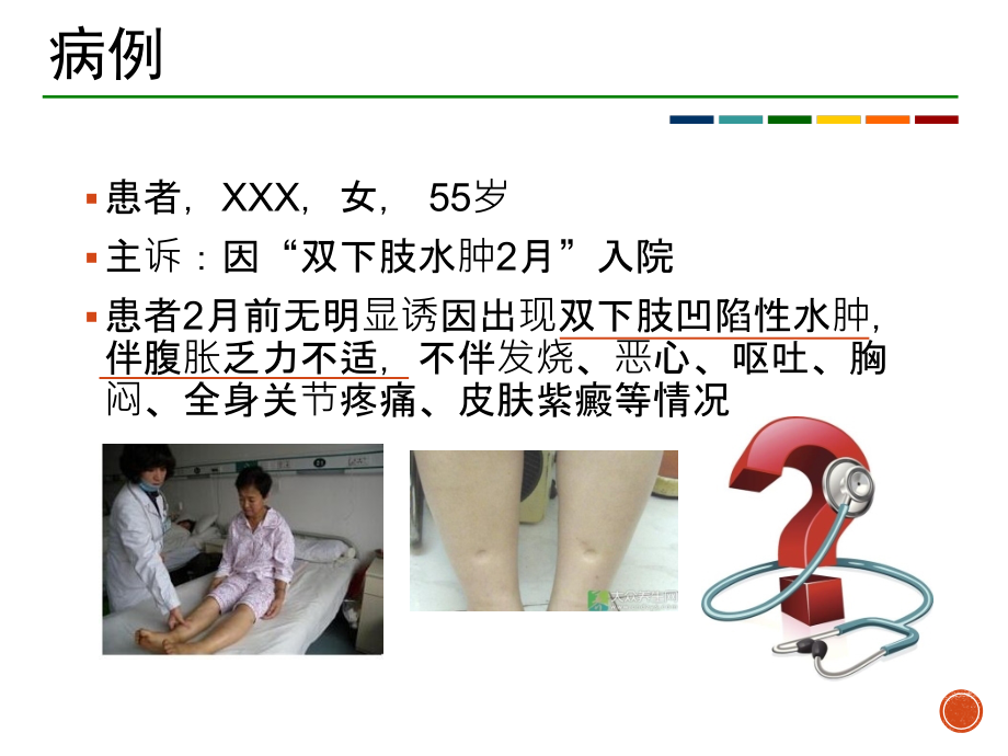 肾病综合征的诊疗和治疗.ppt_第2页