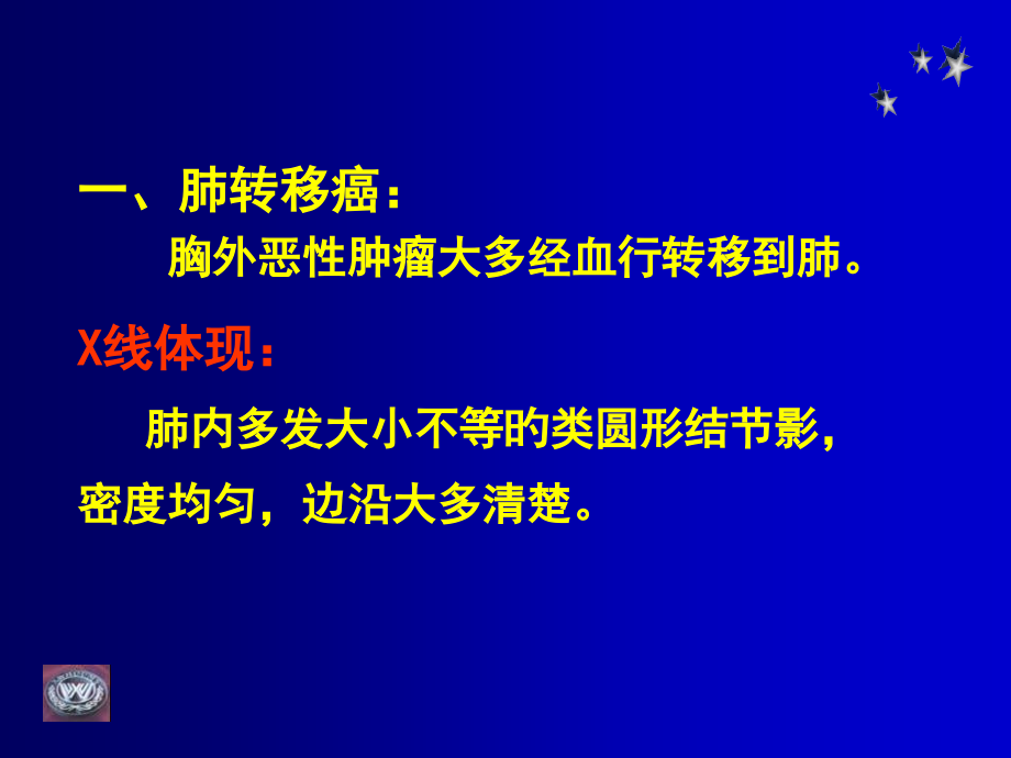 肺部肿瘤影像学诊疗.ppt_第2页