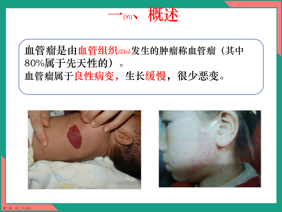 血管瘤的诊断护理查房.pptx_第2页