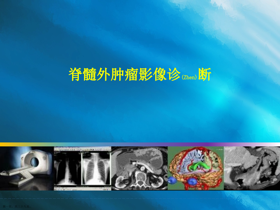 脊髓外肿瘤影像的诊断及治疗教学.pptx_第1页