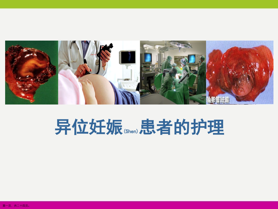 异位妊娠患者的护理与防护.pptx_第1页