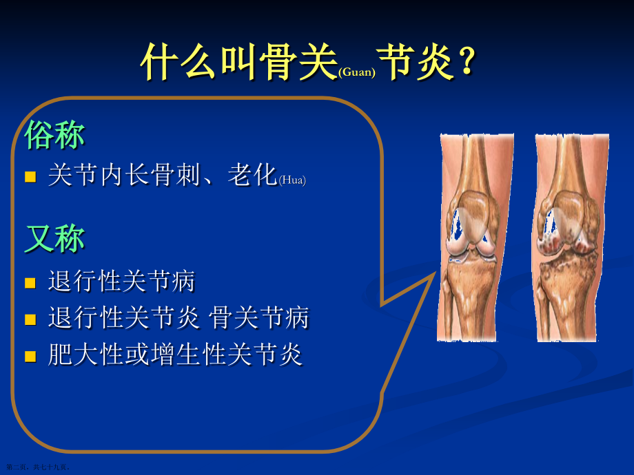 膝关节骨性关节炎的分级诊断与治疗教学.pptx_第2页