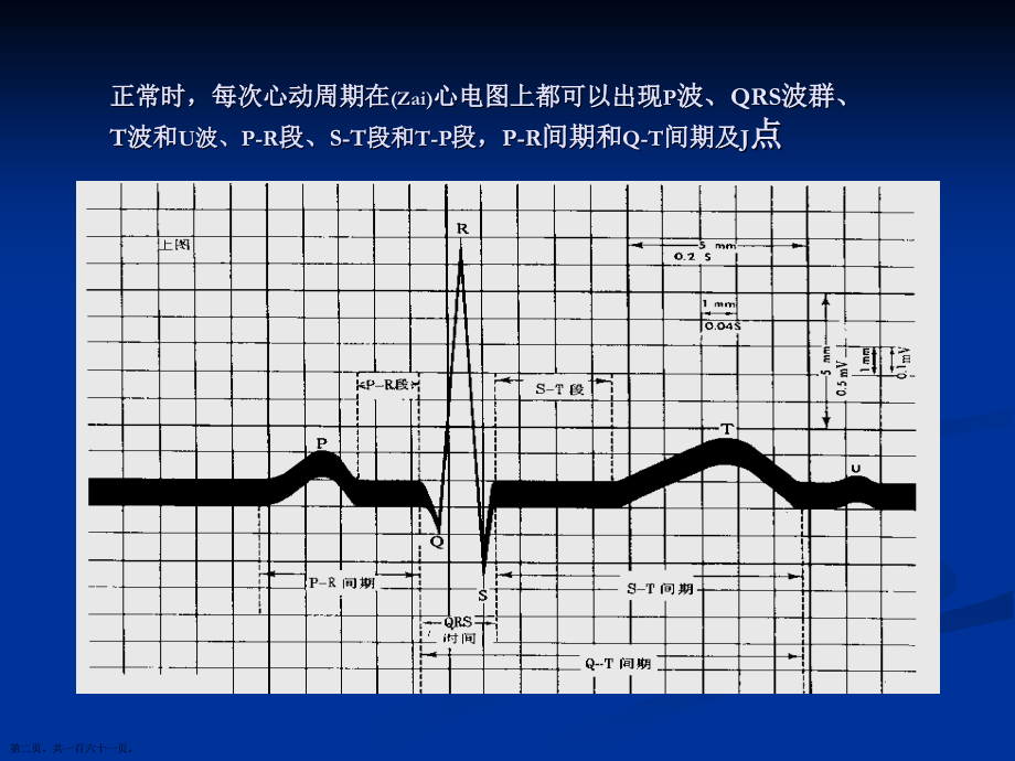 典型心电图治疗及诊断深入培训.pptx_第2页