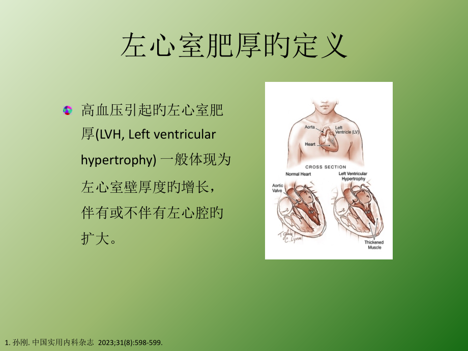 高血压和左心室肥厚.pptx_第2页