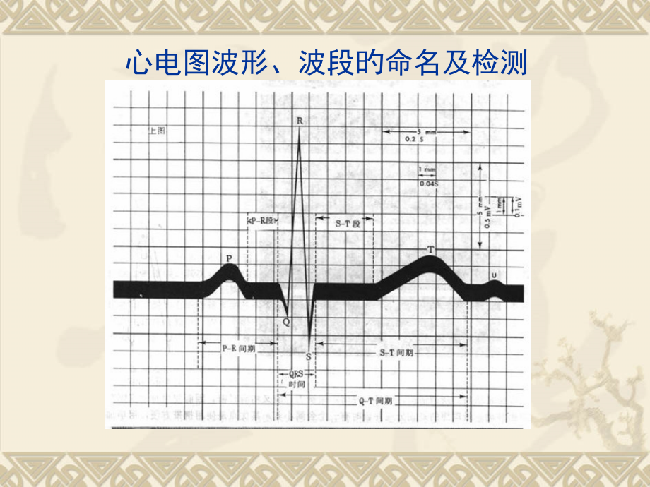 快速分析心电图专业知识.ppt_第2页