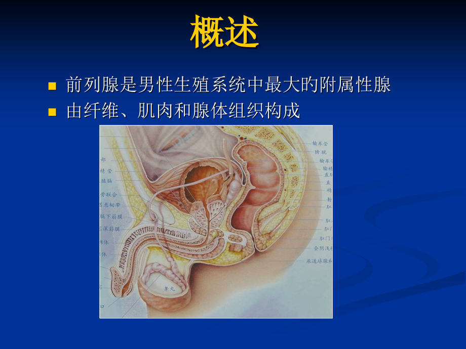 磁共振前列腺癌诊疗标准.pptx_第2页