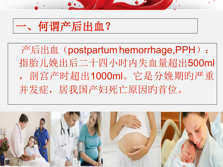产后出血完整版.ppt_第1页