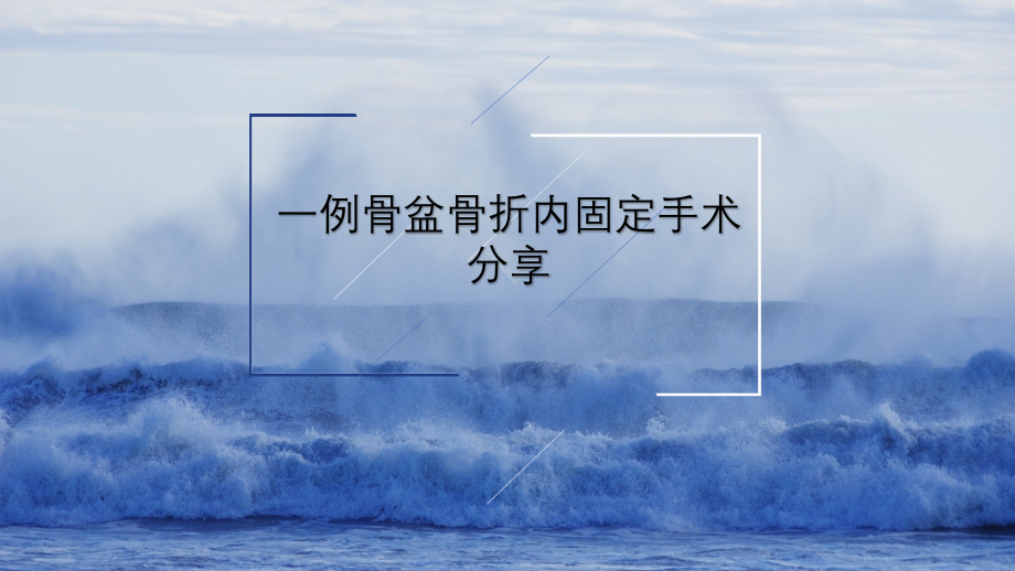骨盆骨折手术配合.pptx_第1页