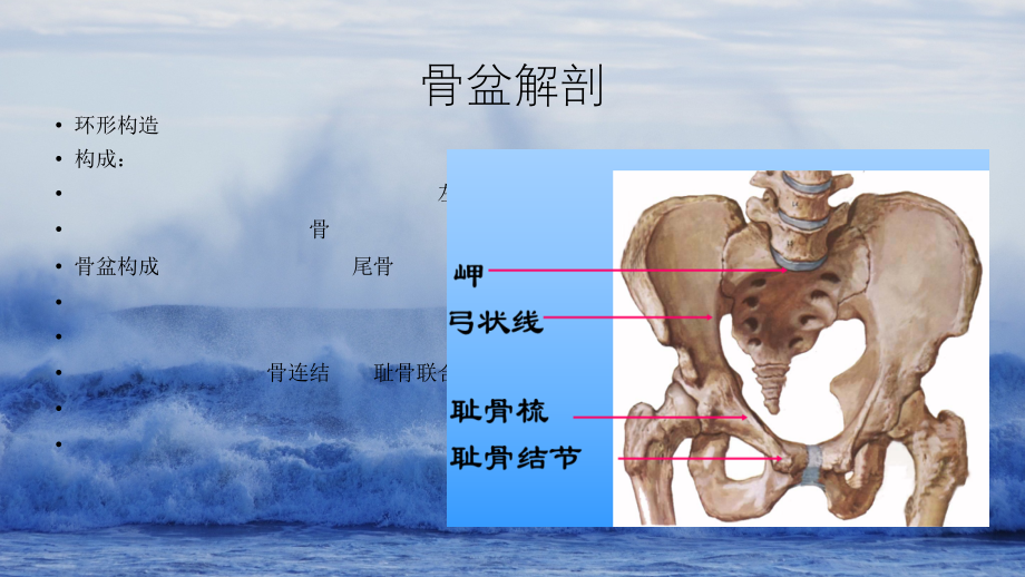 骨盆骨折手术配合.pptx_第2页